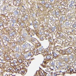 Anti-Ferritin Heavy Chain antibody used in IHC (Paraffin sections) (IHC-P). GTX54014