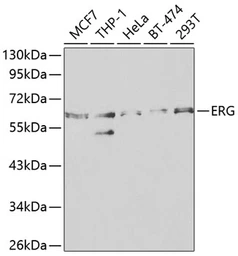 Anti-ERG antibody used in Western Blot (WB). GTX54015