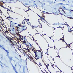 Anti-FABP4 antibody used in IHC (Paraffin sections) (IHC-P). GTX54016