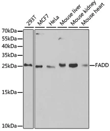 Anti-FADD antibody used in Western Blot (WB). GTX54024
