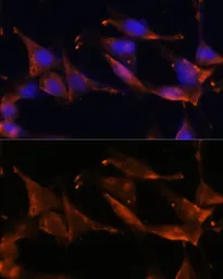 Anti-Fibrinogen gamma antibody used in Immunocytochemistry/ Immunofluorescence (ICC/IF). GTX54026