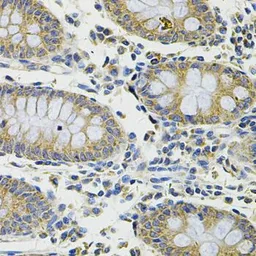 Anti-Gemin 3 antibody used in IHC (Paraffin sections) (IHC-P). GTX54029