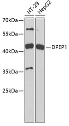 Anti-Dipeptidase 1 antibody used in Western Blot (WB). GTX54046