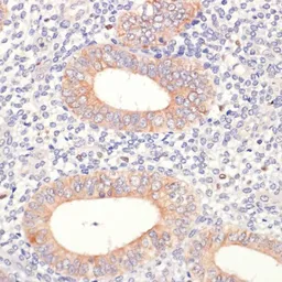 Anti-HMGCR antibody used in IHC (Paraffin sections) (IHC-P). GTX54088