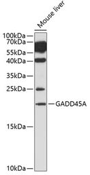 Anti-GADD45A antibody used in Western Blot (WB). GTX54090
