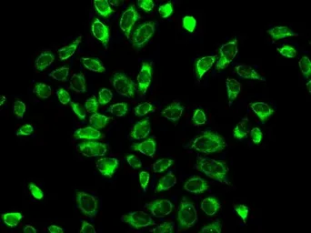 Anti-HSD3B2 antibody used in Immunocytochemistry/ Immunofluorescence (ICC/IF). GTX54092