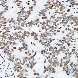 Anti-Histone H3K9me2 (di-methyl Lys9) antibody used in IHC (Paraffin sections) (IHC-P). GTX54102