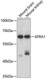 Anti-GDNF Receptor alpha 1 antibody used in Western Blot (WB). GTX54146