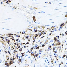 Anti-Lck antibody used in IHC (Paraffin sections) (IHC-P). GTX54287