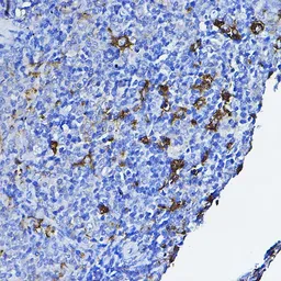 Anti-Lck antibody used in IHC (Paraffin sections) (IHC-P). GTX54287