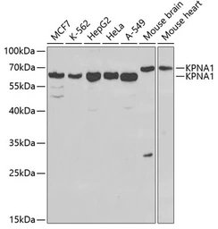 Anti-SRP1 antibody used in Western Blot (WB). GTX54302