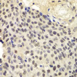 Anti-SRP1 antibody used in IHC (Paraffin sections) (IHC-P). GTX54302