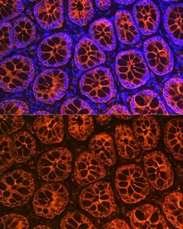 Anti-Cytokeratin 19 antibody used in IHC (Paraffin sections) (IHC-P). GTX54330