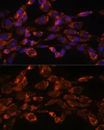 Anti-Monoamine Oxidase A antibody used in Immunocytochemistry/ Immunofluorescence (ICC/IF). GTX54351