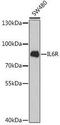 Anti-IL6 Receptor antibody used in Western Blot (WB). GTX54364