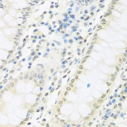 Anti-IRF3 antibody used in IHC (Paraffin sections) (IHC-P). GTX54366
