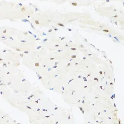 Anti-IRF3 antibody used in IHC (Paraffin sections) (IHC-P). GTX54366