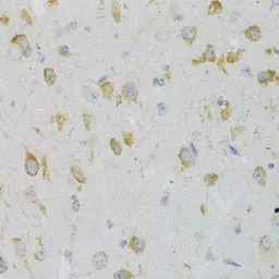 Anti-GPR54 antibody used in IHC (Paraffin sections) (IHC-P). GTX54378