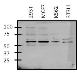Anti-GATA6 antibody used in Western Blot (WB). GTX54528