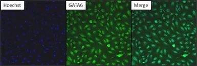 Anti-GATA6 antibody used in Immunocytochemistry/ Immunofluorescence (ICC/IF). GTX54528