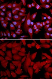 Anti-PSMA4 antibody used in Immunocytochemistry/ Immunofluorescence (ICC/IF). GTX54544