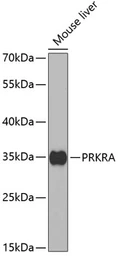 Anti-PACT antibody used in Western Blot (WB). GTX54546