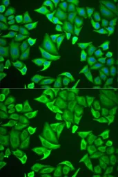 Anti-Neuroglobin antibody used in Immunocytochemistry/ Immunofluorescence (ICC/IF). GTX54552
