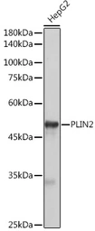 Anti-ADFP antibody used in Western Blot (WB). GTX54569