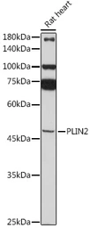 Anti-ADFP antibody used in Western Blot (WB). GTX54569