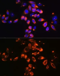 Anti-ADFP antibody used in Immunocytochemistry/ Immunofluorescence (ICC/IF). GTX54569