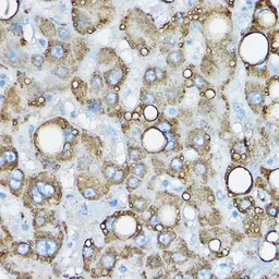 Anti-ADFP antibody used in IHC (Paraffin sections) (IHC-P). GTX54569