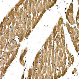 Anti-PDGF beta antibody used in IHC (Paraffin sections) (IHC-P). GTX54575
