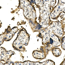 Anti-PDGF beta antibody used in IHC (Paraffin sections) (IHC-P). GTX54575