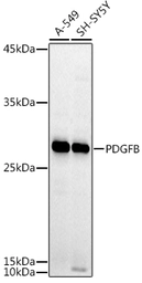 Anti-PDGF beta antibody used in Western Blot (WB). GTX54575
