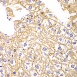 Anti-PPP2R2A antibody used in IHC (Paraffin sections) (IHC-P). GTX54580