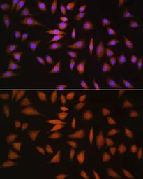Anti-NRBF2 antibody used in Immunocytochemistry/ Immunofluorescence (ICC/IF). GTX54585