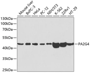 Anti-EBP1 antibody used in Western Blot (WB). GTX54589