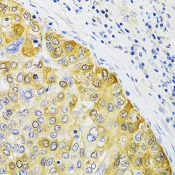 Anti-EBP1 antibody used in IHC (Paraffin sections) (IHC-P). GTX54589