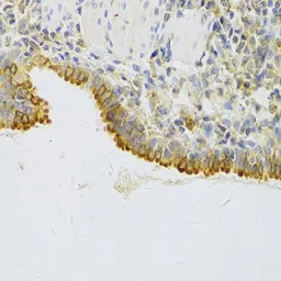 Anti-EBP1 antibody used in IHC (Paraffin sections) (IHC-P). GTX54589