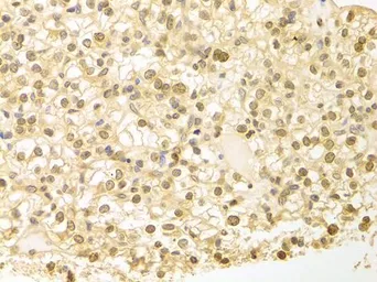 Anti-PLCB1 antibody used in IHC (Paraffin sections) (IHC-P). GTX54594