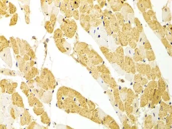 Anti-PLCB1 antibody used in IHC (Paraffin sections) (IHC-P). GTX54594