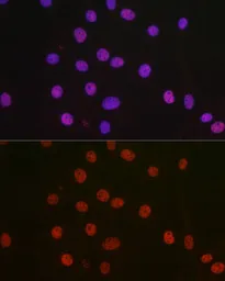 Anti-p54nrb antibody used in Immunocytochemistry/ Immunofluorescence (ICC/IF). GTX54596