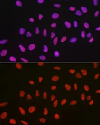 Anti-p54nrb antibody used in Immunocytochemistry/ Immunofluorescence (ICC/IF). GTX54596