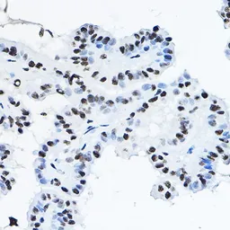 Anti-p54nrb antibody used in IHC (Paraffin sections) (IHC-P). GTX54596