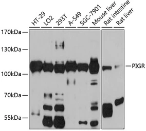 Anti-PIGR antibody used in Western Blot (WB). GTX54608
