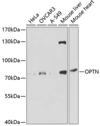 Anti-Optineurin antibody used in Western Blot (WB). GTX54617