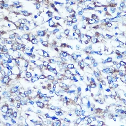 Anti-Optineurin antibody used in IHC (Paraffin sections) (IHC-P). GTX54617