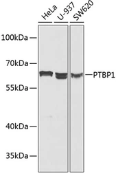 Anti-PTBP1 antibody used in Western Blot (WB). GTX54619