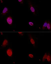 Anti-PTBP1 antibody used in Immunocytochemistry/ Immunofluorescence (ICC/IF). GTX54619