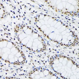 Anti-PTBP1 antibody used in IHC (Paraffin sections) (IHC-P). GTX54619